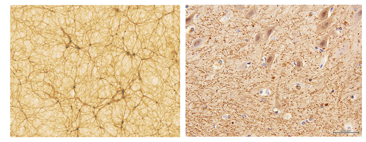 Cosmic Web and Brain Comparison